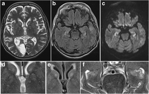 Fig. 27