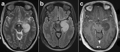 Fig. 17