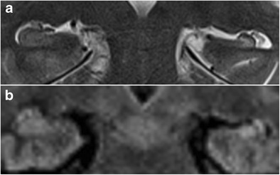 Fig. 10