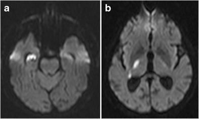 Fig. 22