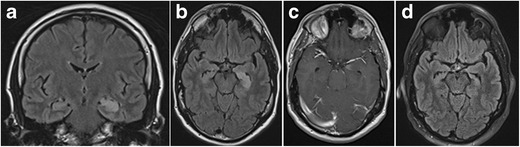 Fig. 16