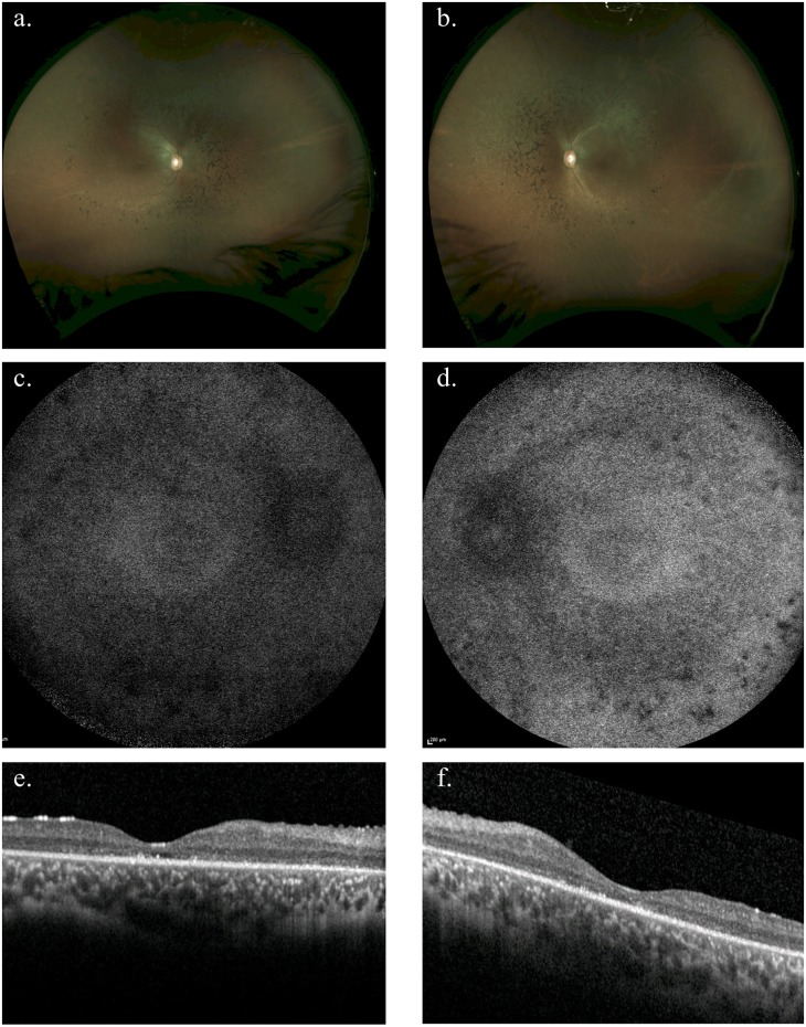 Fig 3