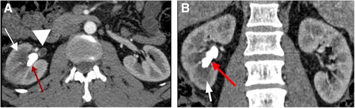 FIG. 1.