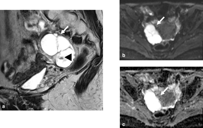 Figure 11.