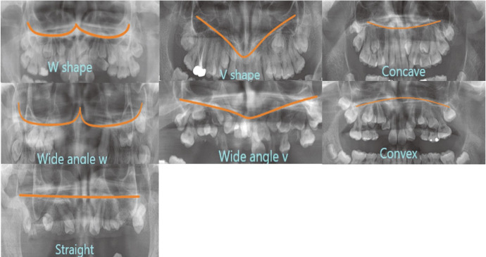 Fig. 5