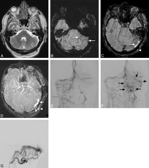 Fig 2.