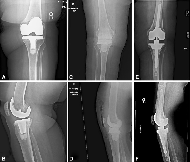 Fig. 1A–F