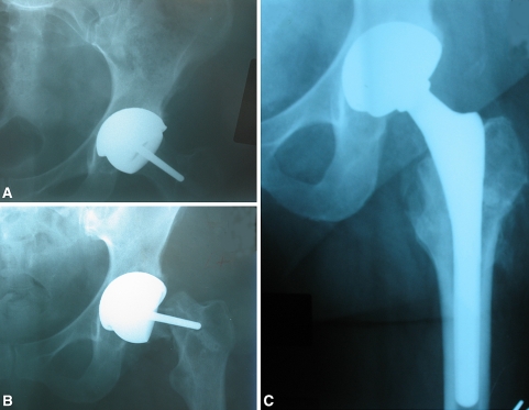 Fig. 1A–C