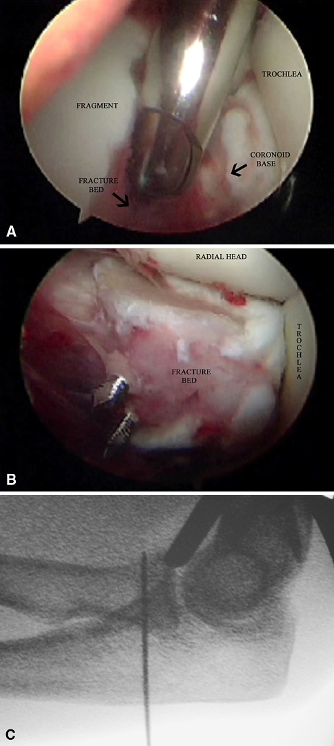 Fig. 2A–C