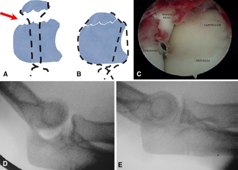 Fig. 3A–E