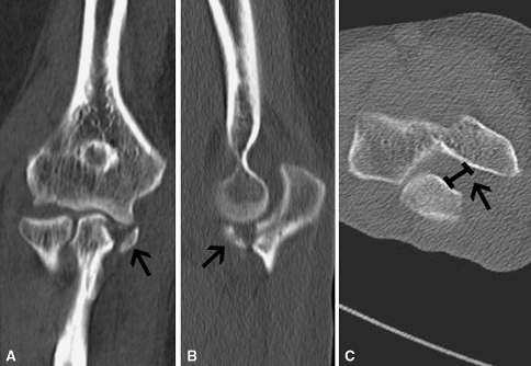 Fig. 1A–C