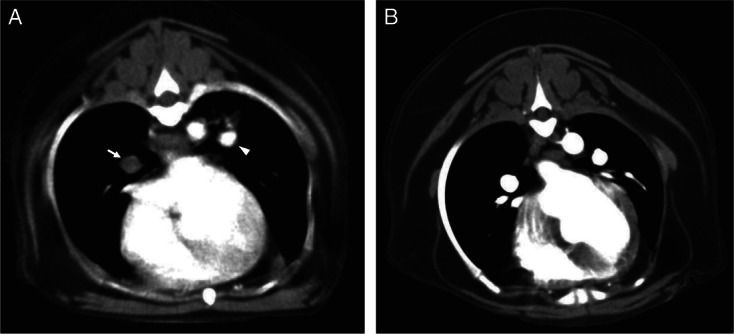 FIG 1