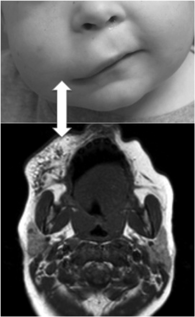 FIG. 2.