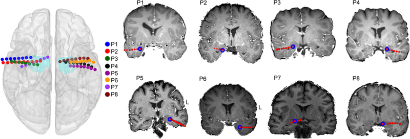 FIG. 2.