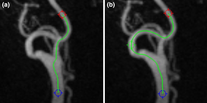 Fig. 1