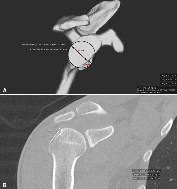 Fig. 4A–B