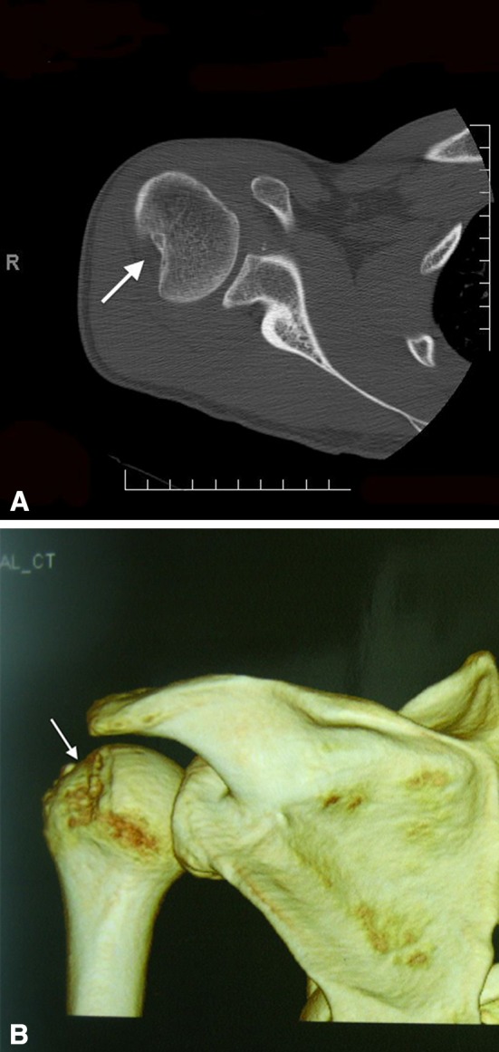 Fig. 1A–B