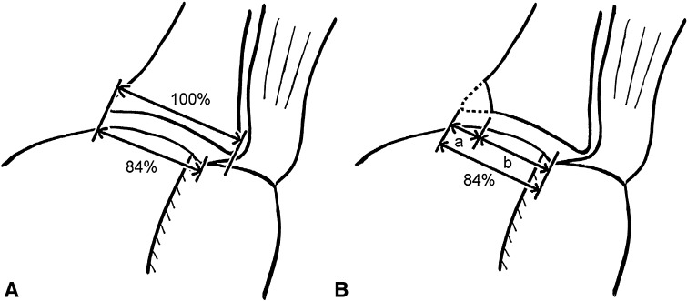 Fig. 2A–B