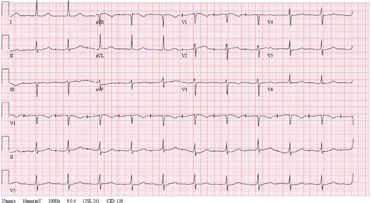 Figure 2