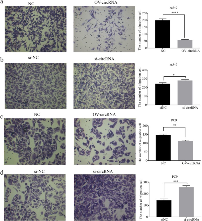 Circigf R Inhibits Cell Invasion And Migration In Nonsmall Cell Lung