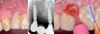 Fig. 12
