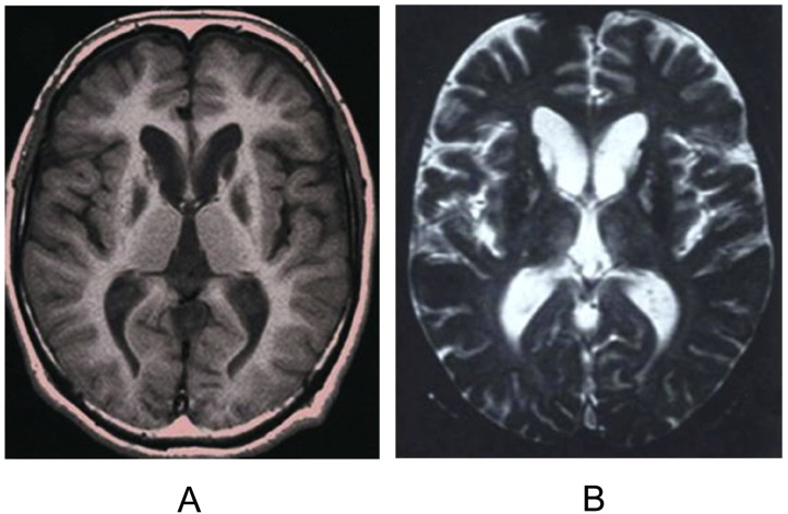 Fig. 2