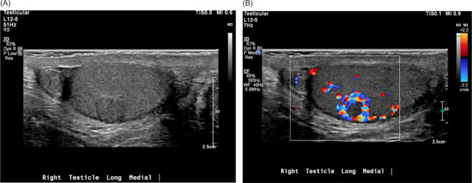 Figure 2: