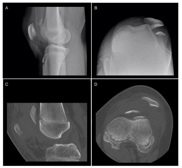 Fig. 2