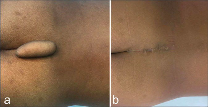 Figure 1: