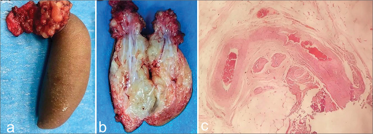 Figure 3: