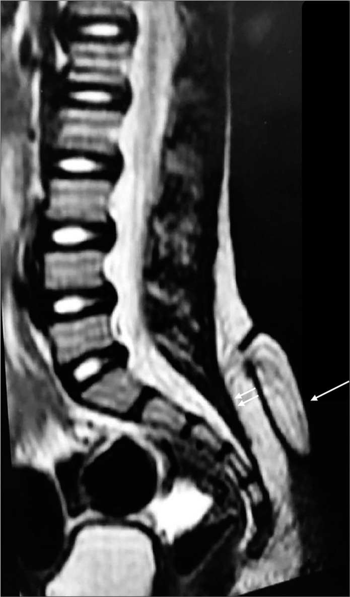 Figure 2: