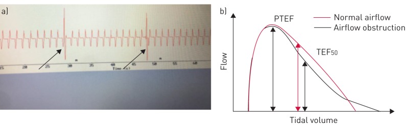 FIGURE 1