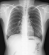 Fig 1 –