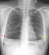 Fig 5 –