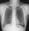 Fig 3 –