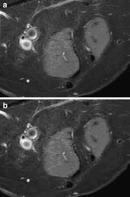 Fig 3.