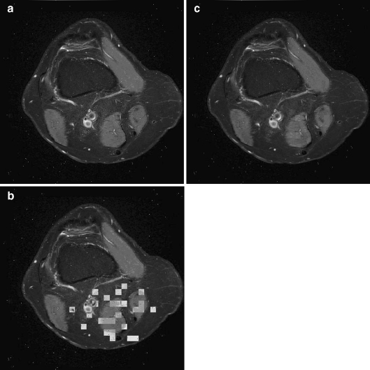 Fig 5.