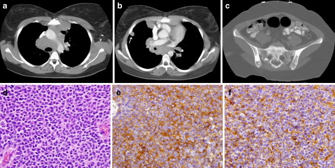 Fig. 11