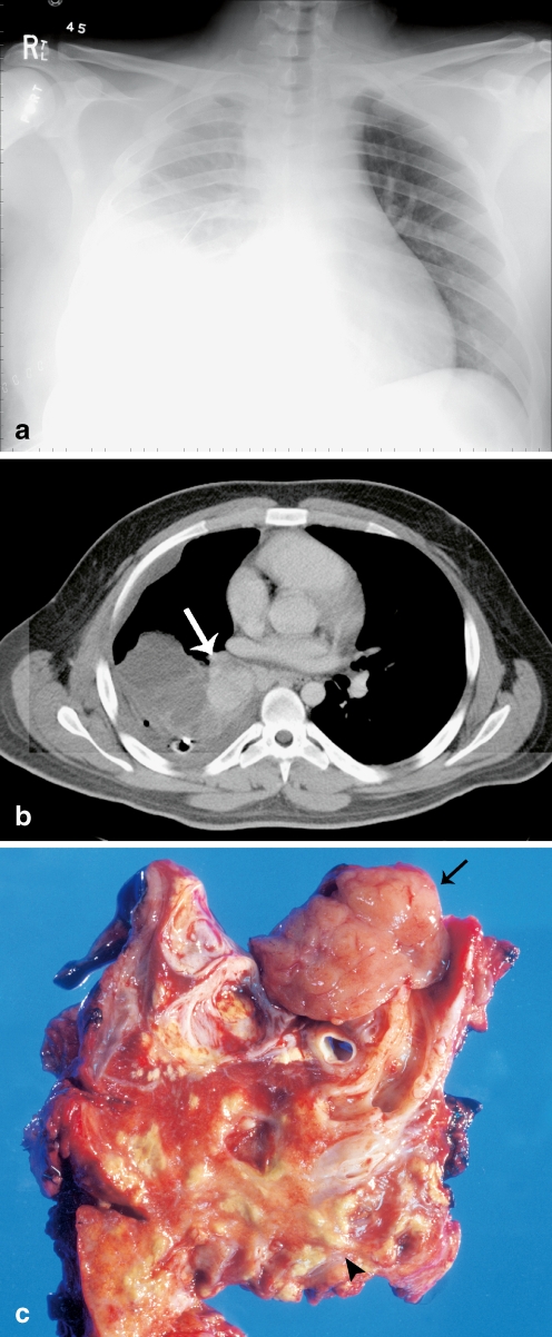 Fig. 10