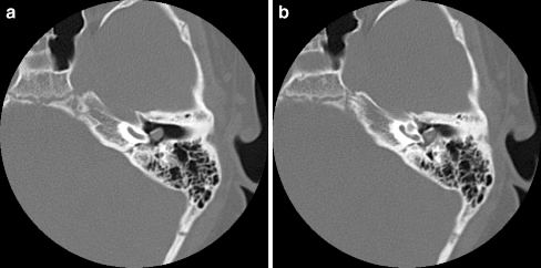 Fig. 12