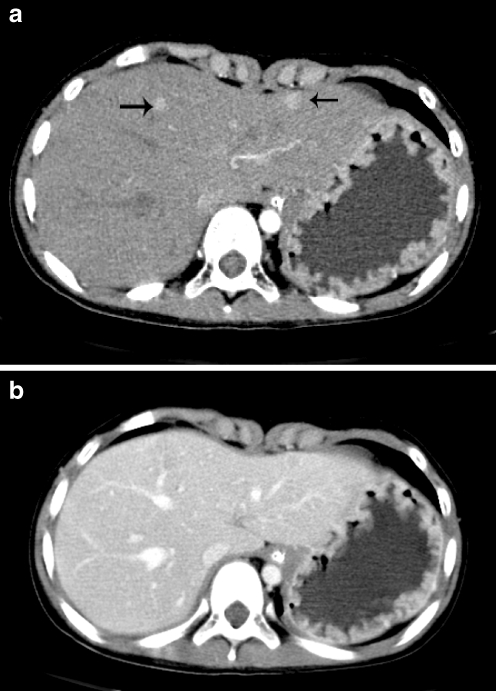 Fig. 1