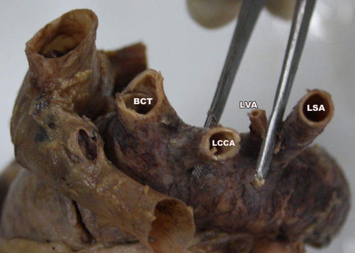 [Table/Fig-2]: