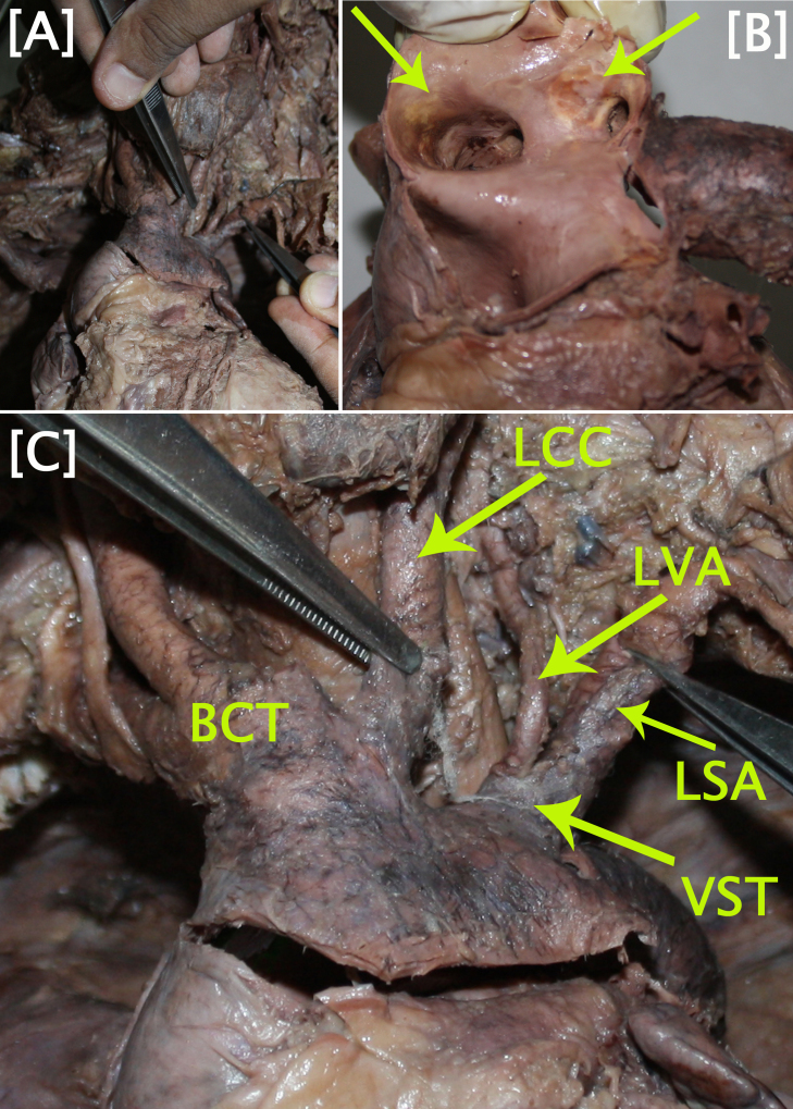 [Table/Fig-1A-C]: