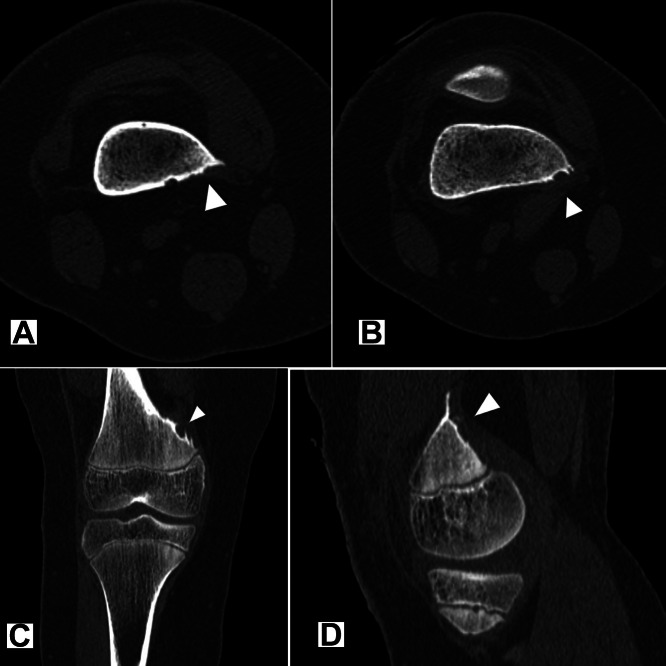 Fig 2