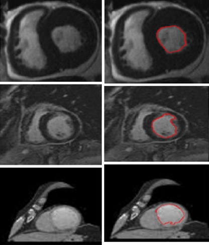 Fig. 11