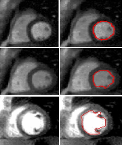 Fig. 12