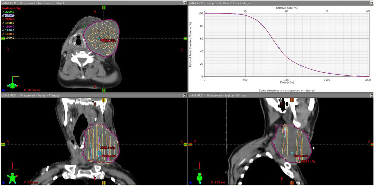 Figure 4.