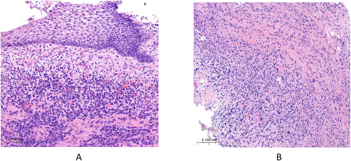 Fig. 14