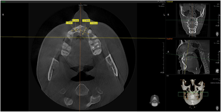 Fig. 2