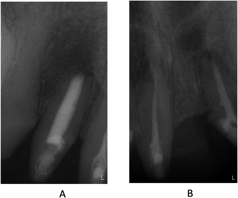 Fig. 16